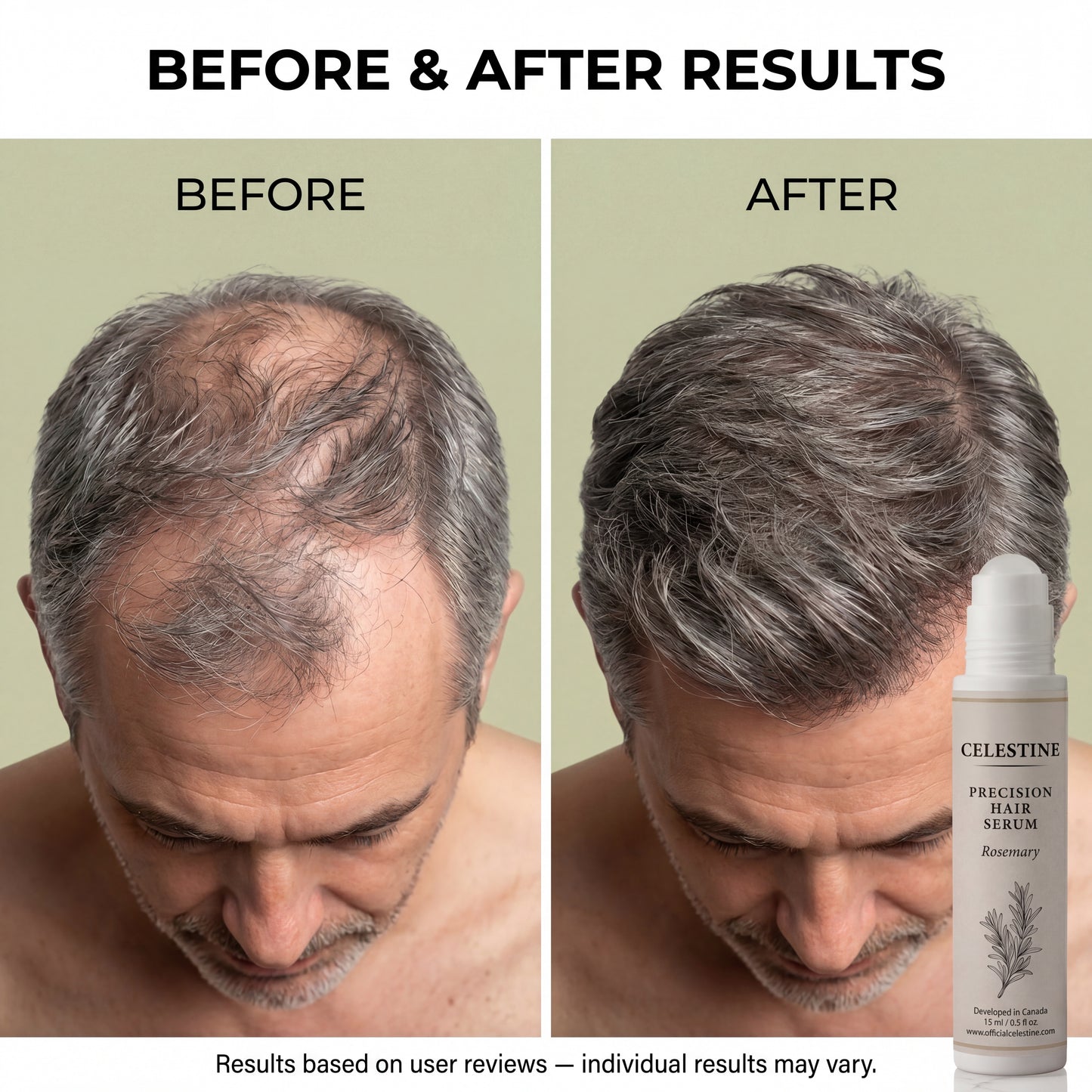 Natural rosemary serum — Targeted root care between washes