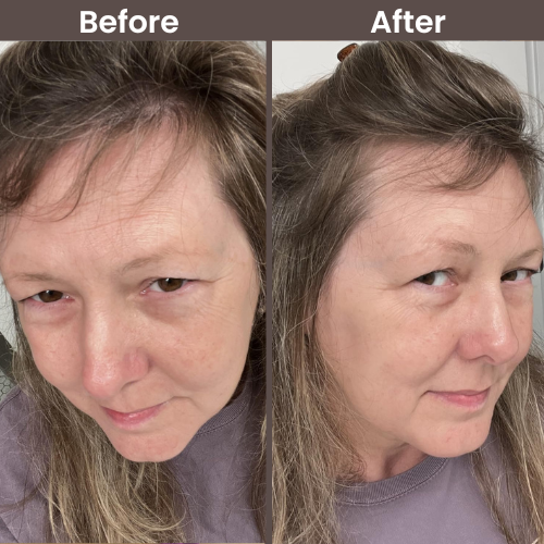 Customer before and after 5