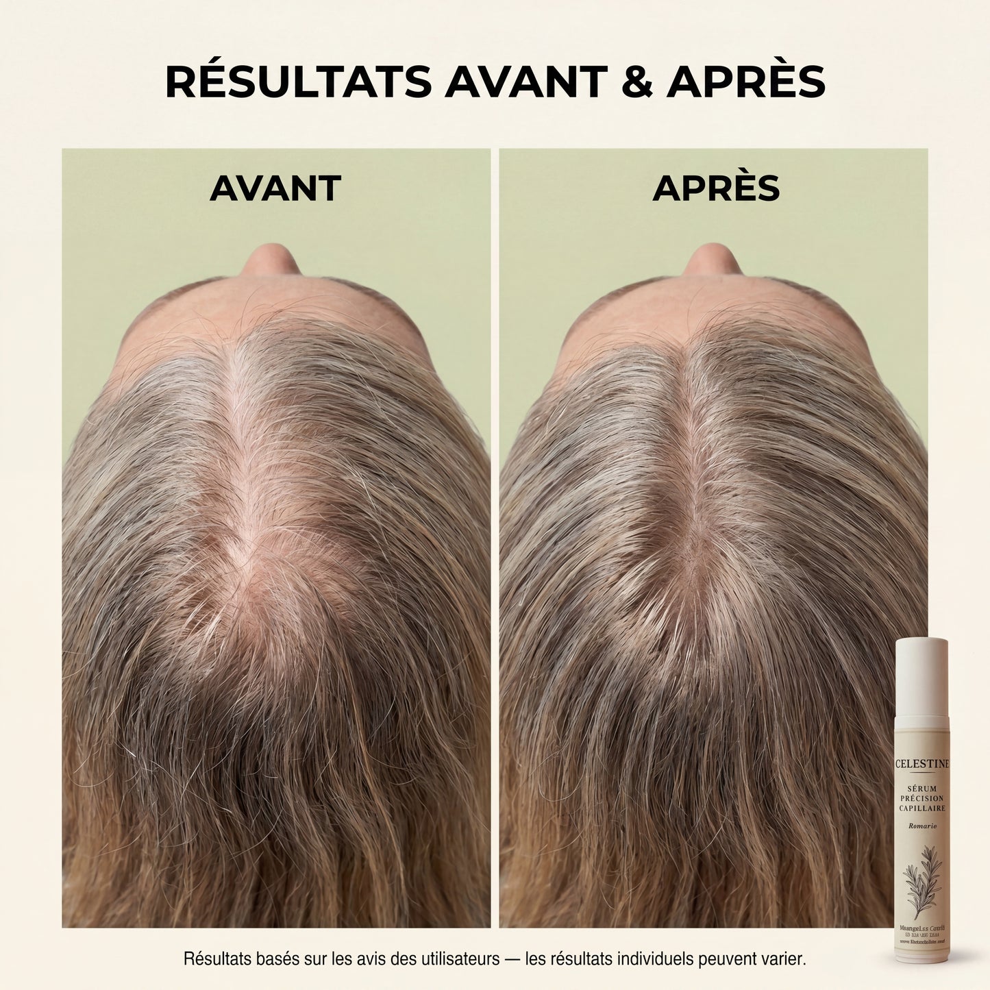 SÉRUM NATUREL AU ROMARIN — LE SOIN CIBLÉ QUI AGIT PENDANT DES HEURES