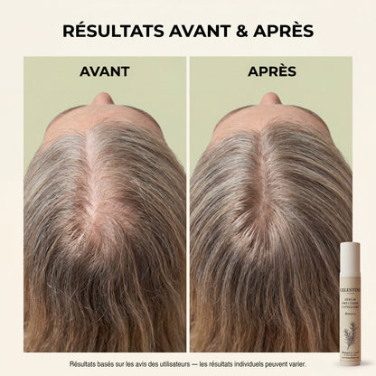 SÉRUM NATUREL AU ROMARIN — LE SOIN CIBLÉ QUI AGIT PENDANT DES HEURES