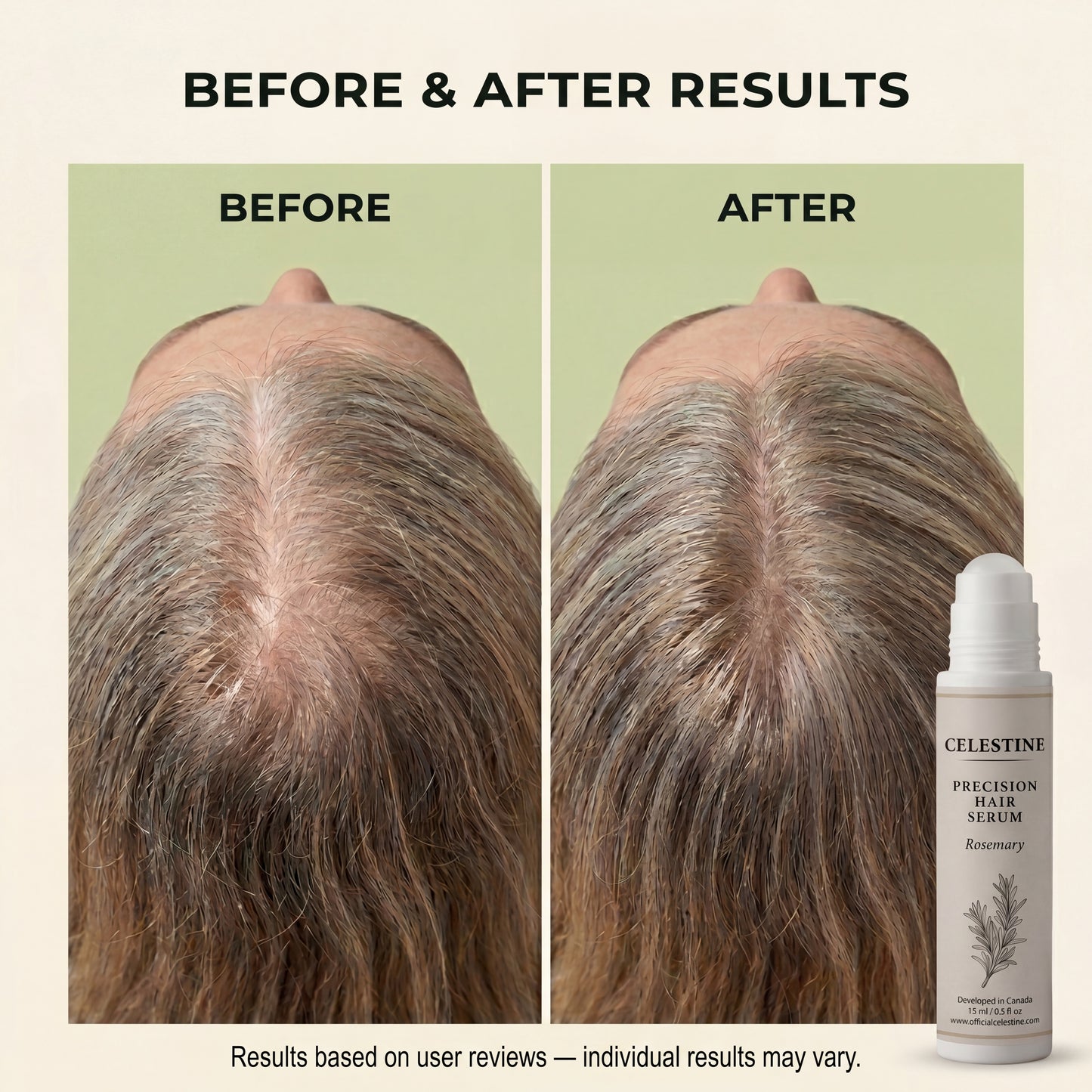 Natural rosemary serum — Targeted root care between washes