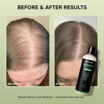 Organic Rosemary & Keratin Shampoo — For Thicker-Looking, Fuller Hair