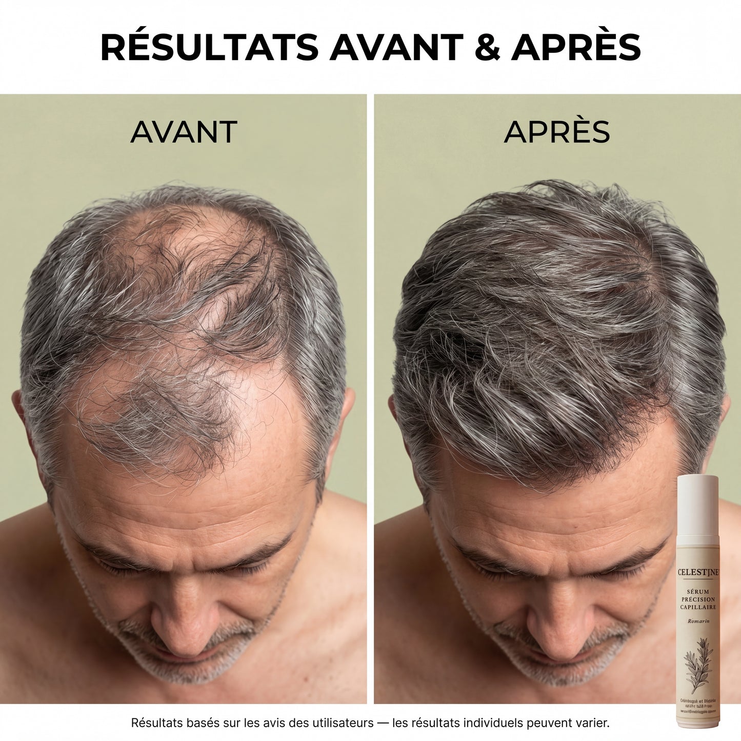 SÉRUM NATUREL AU ROMARIN — LE SOIN CIBLÉ QUI AGIT PENDANT DES HEURES