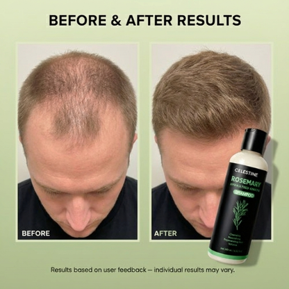 ROSEMARY + KERATIN COMPLEX FOR MEN — FOR STRONGER, THICKER-LOOKING HAIR