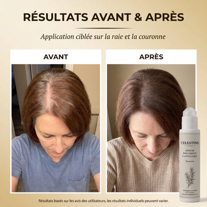 SÉRUM NATUREL AU ROMARIN — LE SOIN CIBLÉ QUI AGIT PENDANT DES HEURES