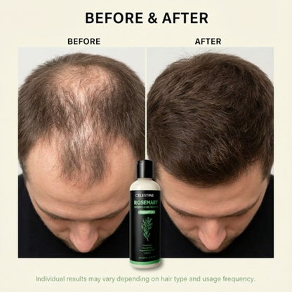 ROSEMARY + KERATIN COMPLEX FOR MEN — FOR STRONGER, THICKER-LOOKING HAIR