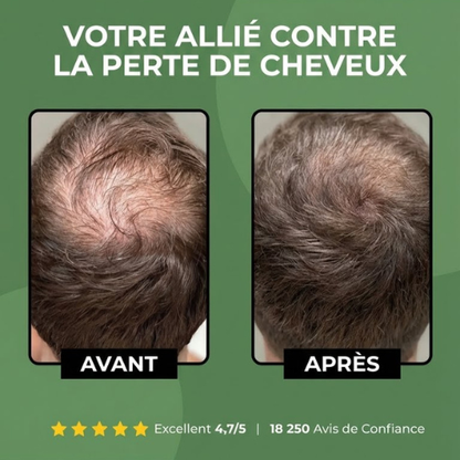 Szampon Celestine — Aktywacja Des Racines Et Repousse Pour Les Hommes