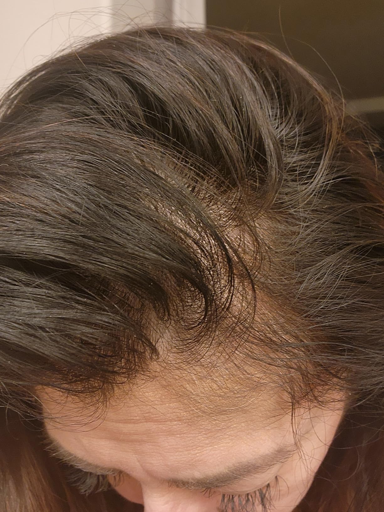 Après — repousse visible