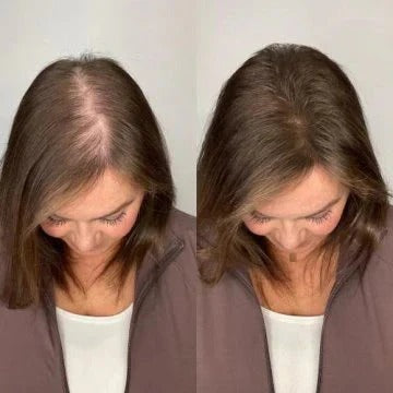 Before and after hair removal comparison