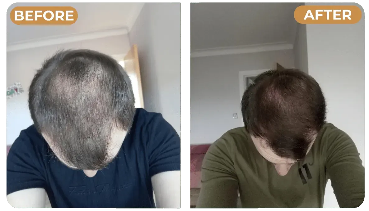 Avant / Après - racine