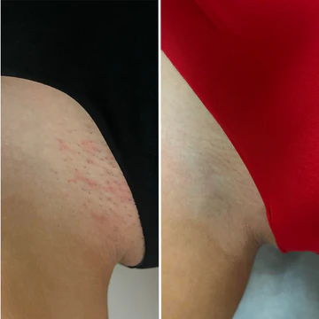 Customer before and after 2