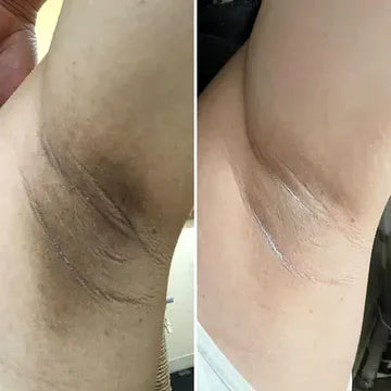 Customer before and after 3